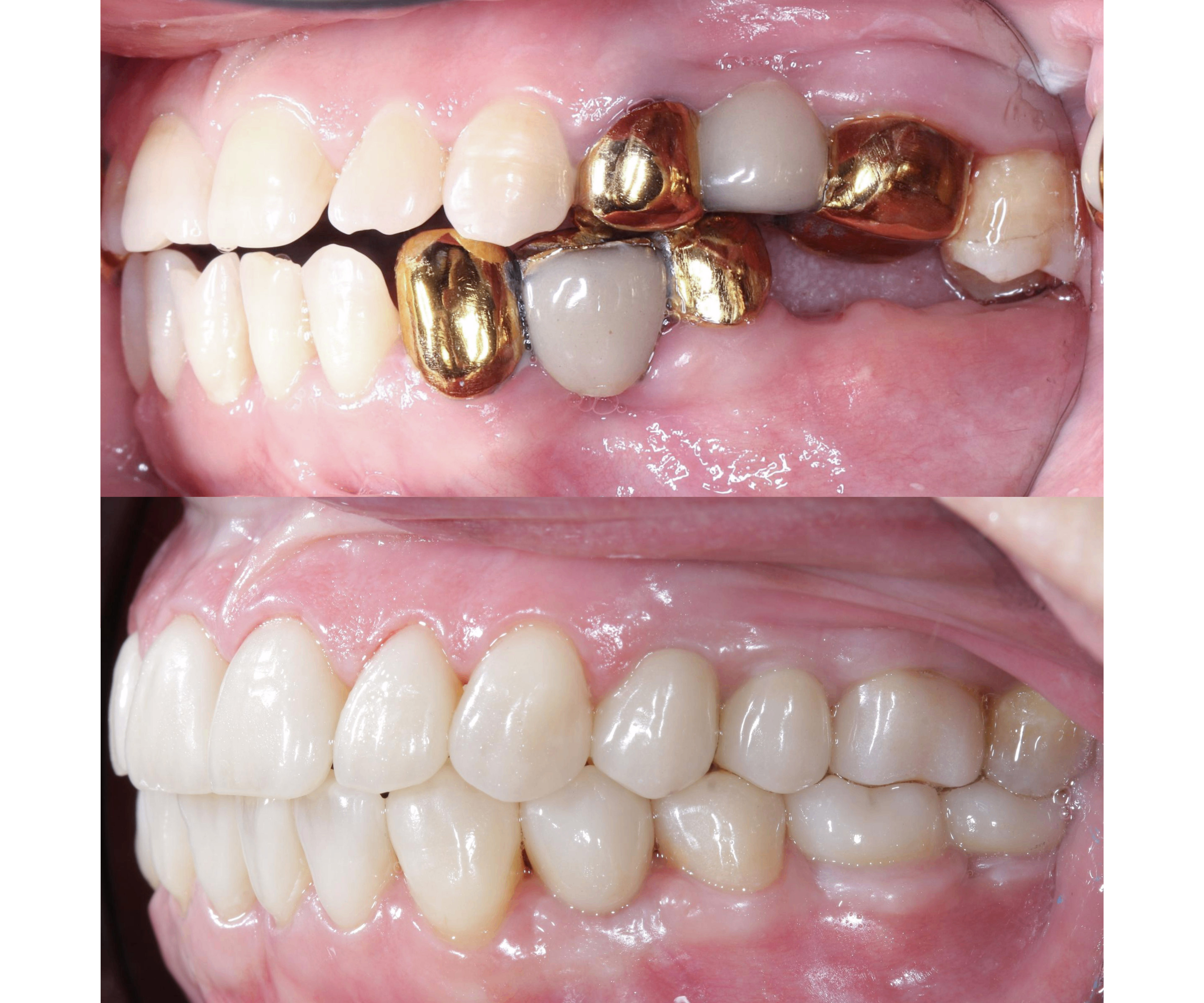 Dentist is checking up a patient with an ortodental system